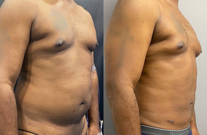 before_after_image_combined