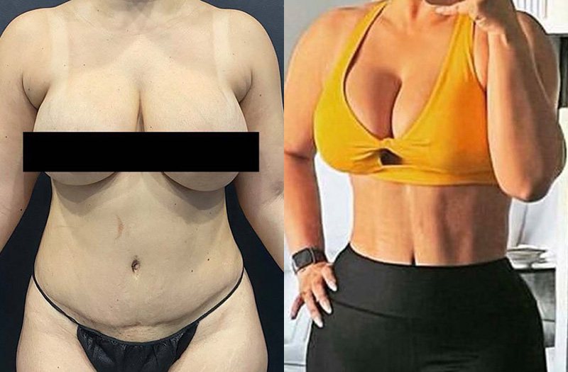 before_after_image_combined