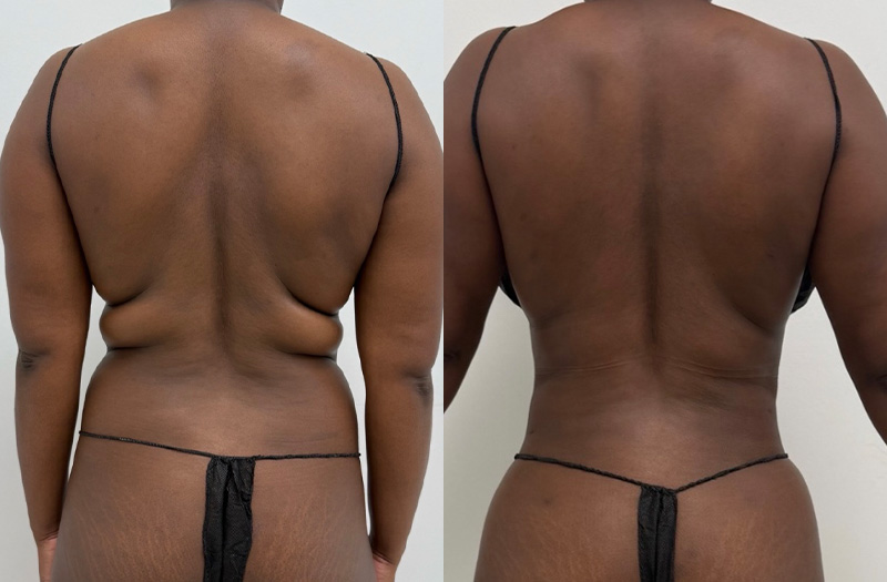 before_after_image_combined