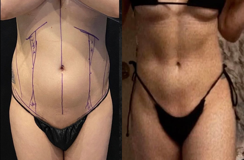 before_after_image_combined