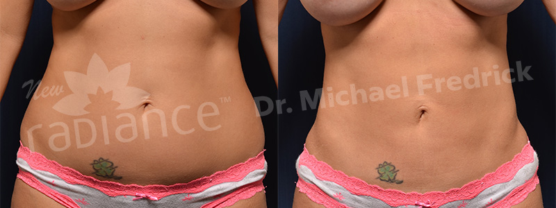 before_after_image_combined